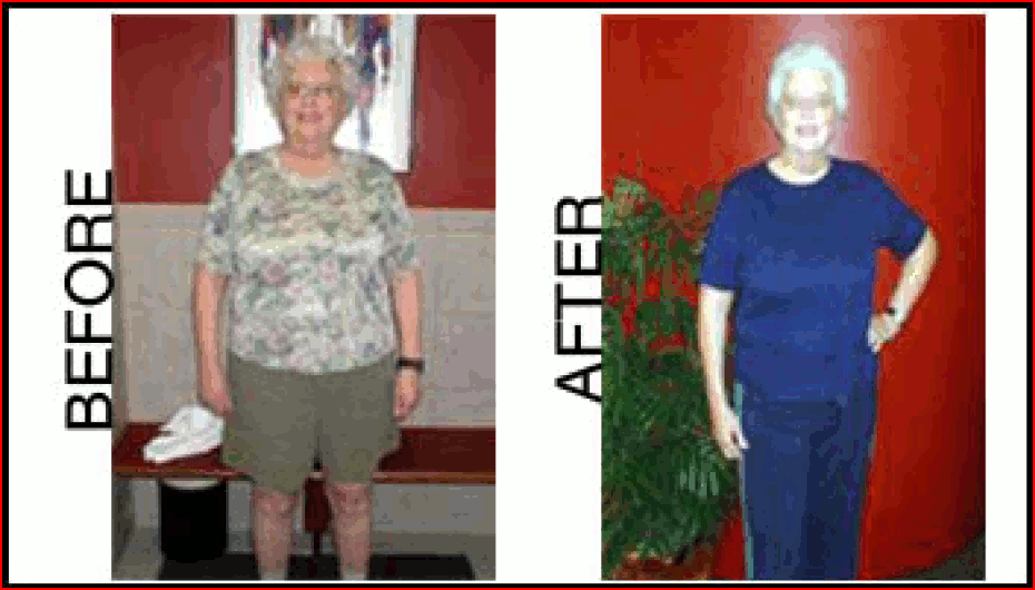JPeacock_BeforeAfter Success Stories